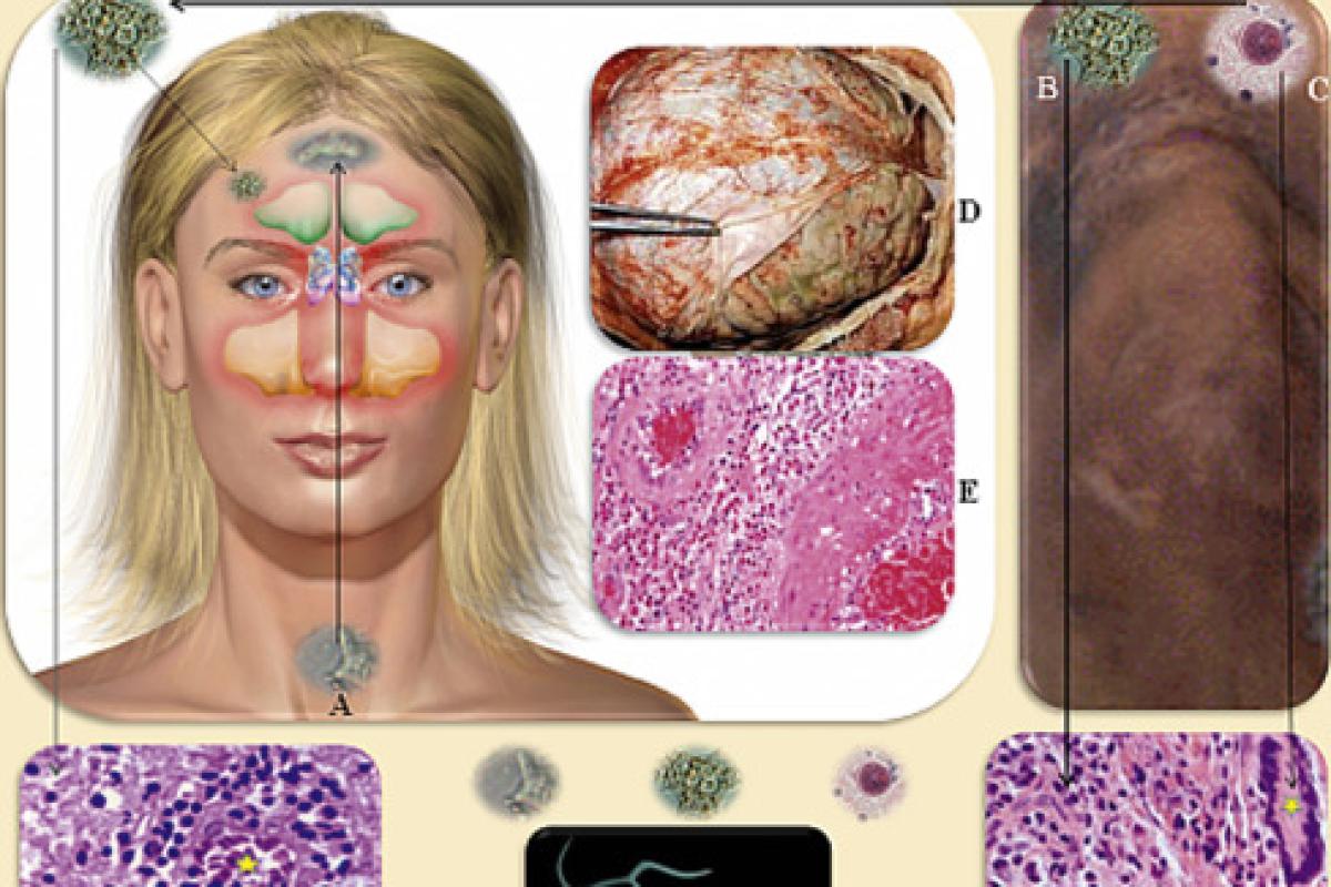 do-not-bath-in-polluted-water-bodies-kerala-minister-reveals-shocking-information