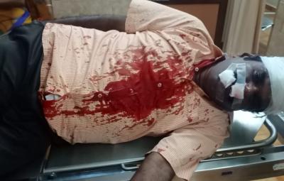 virudhunagar-kumudam-reporter-karthi-assaulted-by-admk-men