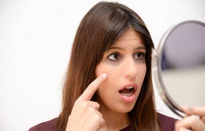 easy-tips-for-dark-circle-under-eye