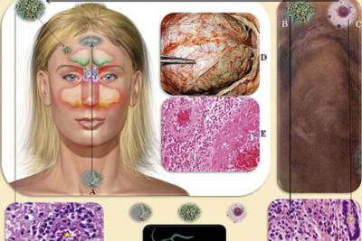 do-not-bath-in-polluted-water-bodies-kerala-minister-reveals-shocking-information