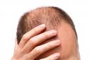 Youth suicide for baldness head and not yet marriage at Madurai