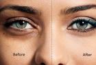 how-to-cure-dark-circles-with-help-of-natural-items
