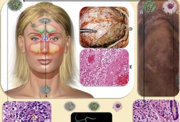 do-not-bath-in-polluted-water-bodies-kerala-minister-reveals-shocking-information