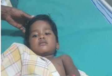 A-stray-dog-bit-a-4-year-old-girl-playing-in-front-of-her-house-in-manur